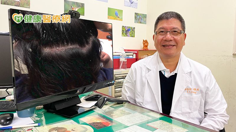 乾癬性關節炎超前部署 健康生育不是夢!